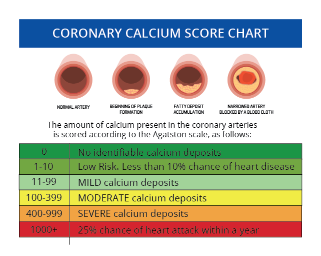 cac score